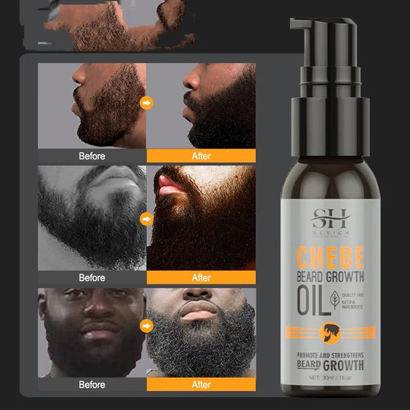 Men’s Beard Growth Oil to Combat Hair Loss Naturally