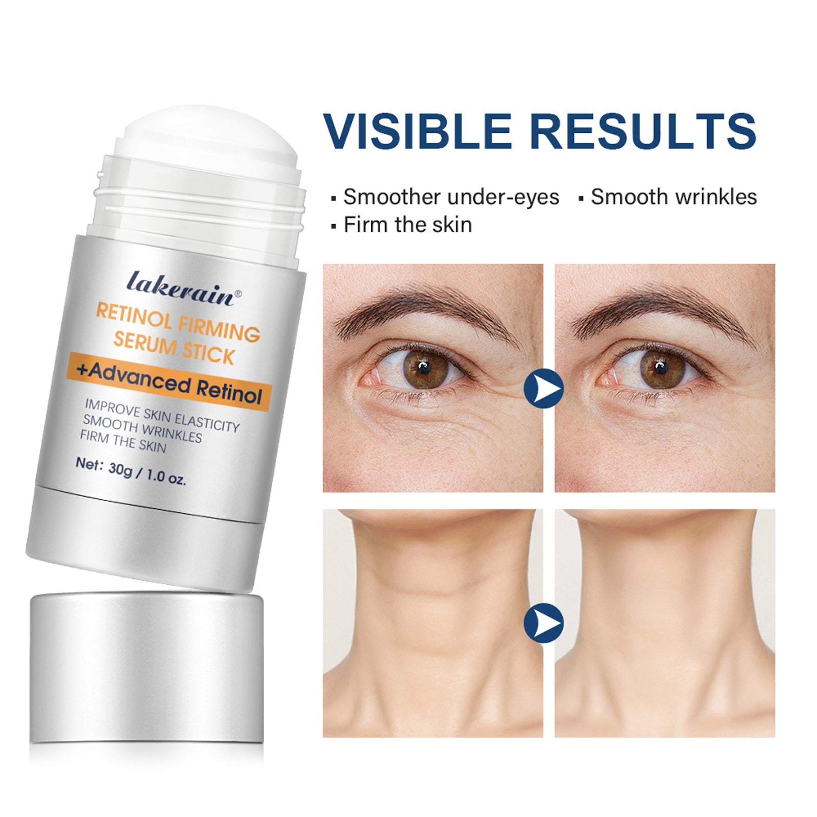 Nourishing Moisturizing Eye Skin Eye Cream