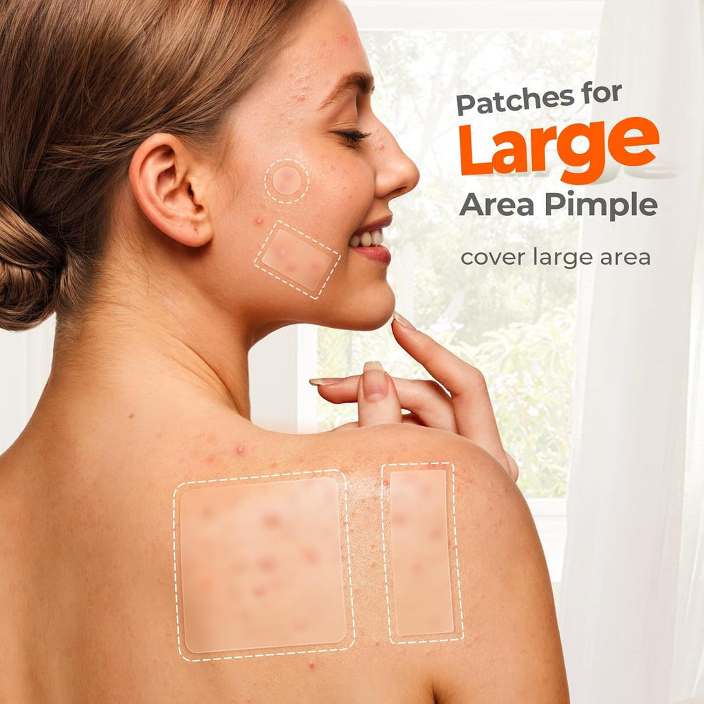 Clear Skin Acne Patch for Quick, Mild Healing