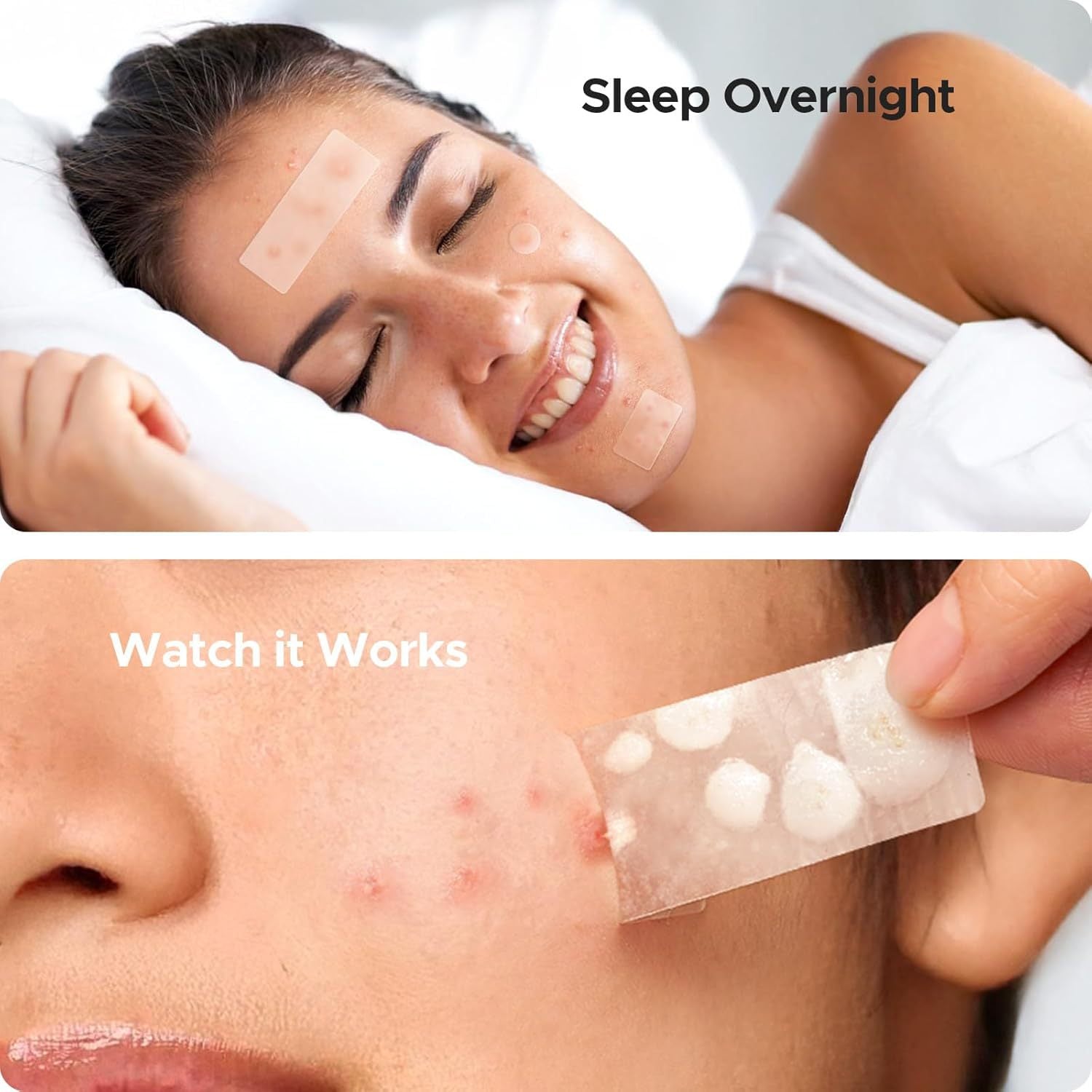 Clear Skin Acne Patch for Quick, Mild Healing